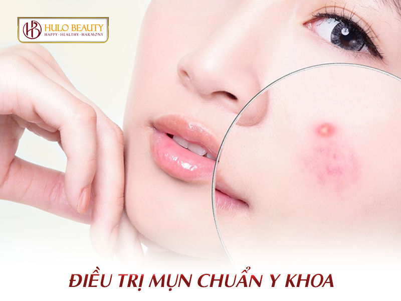 điều trị mụn