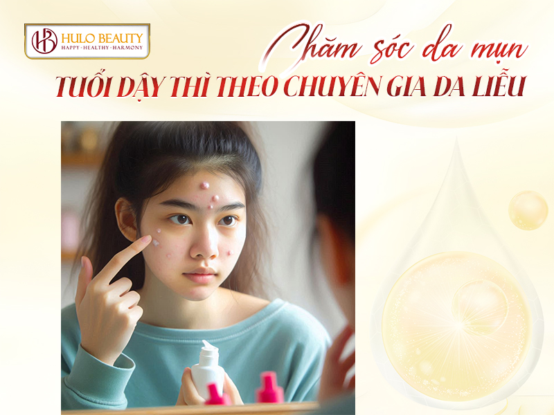 chăm sóc da mụn tuổi dậy thì