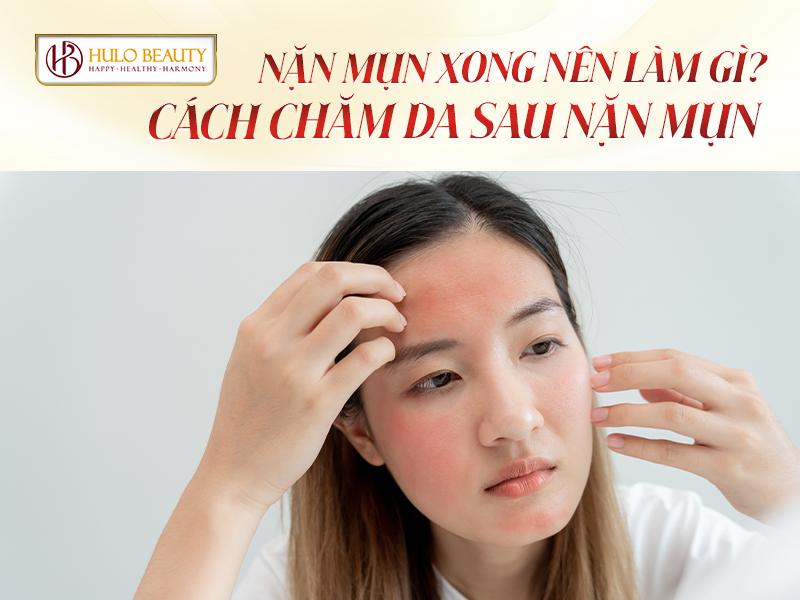 chăm sóc da sau nặn mụn