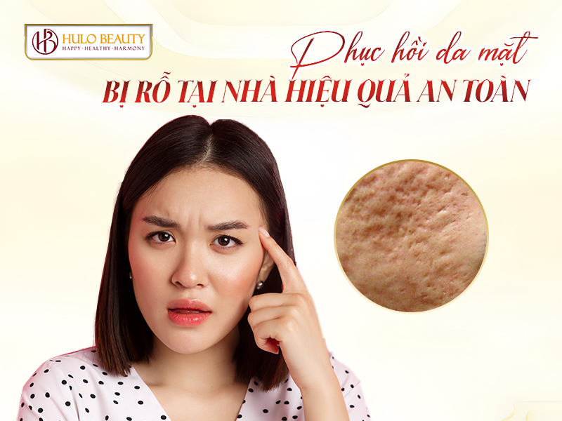 Phục hồi da mặt bị rỗ tại nhà hiệu quả an toàn