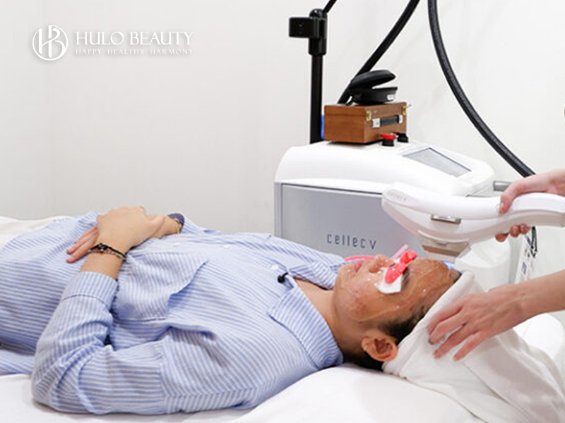 Công nghệ IPL tiêu diệt ổ vi khuẩn trên da