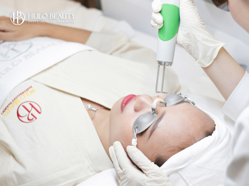 Sử dụng laser Fractional với bước sóng 1064nm tác động sâu vào vùng da cần điều trị