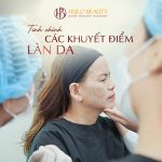 Tinh chỉnh các khuyết điểm làn da